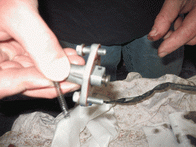 die Steuerkette war widerspenstig